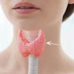 Thyroid gland in woman
